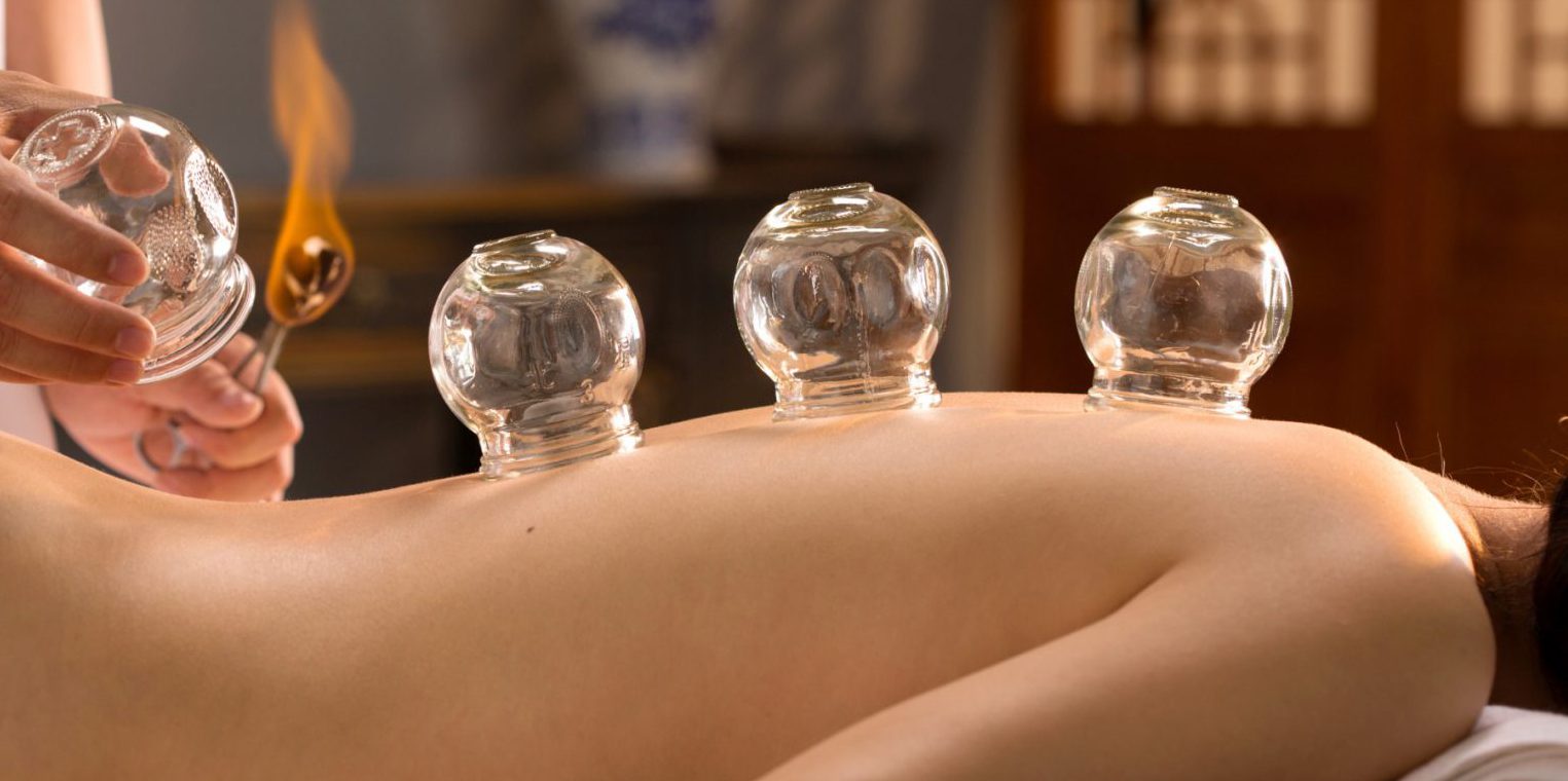 slimming_body_cupping