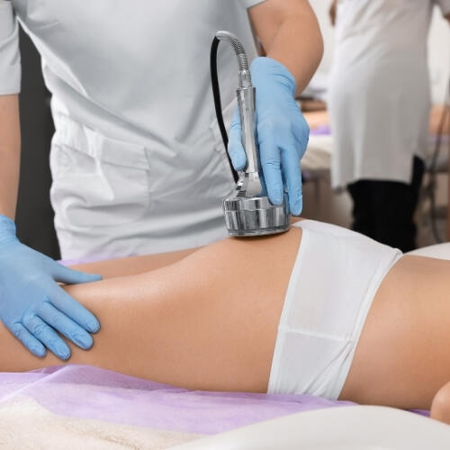 Radiofrequenza estetica