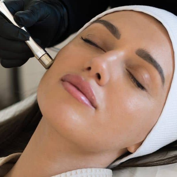 hydrafacial Jesolo