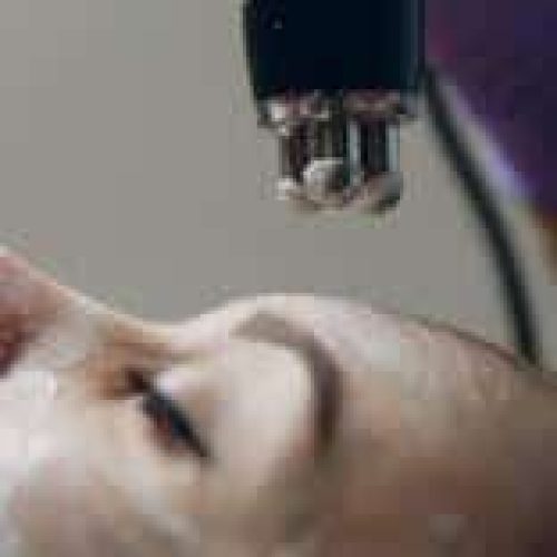 radiofrequenza Studio Estetica Tiffany